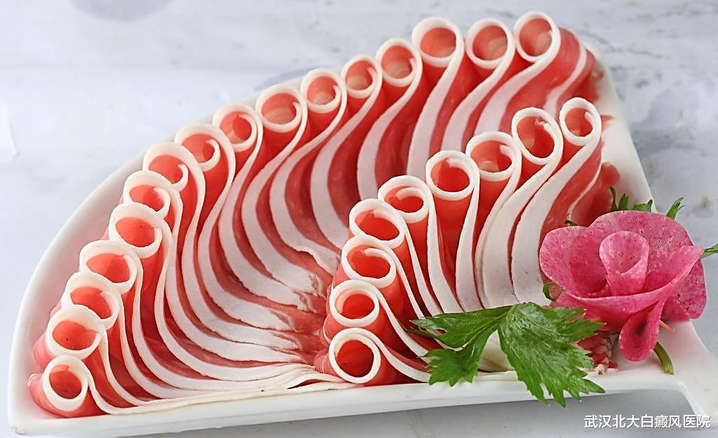武汉北大白癜风医院 白癜风饮食|白癜风患者可以吃羊肉吗？