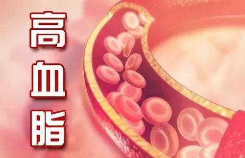 甲状腺结节|76岁退休医生，研究血脂多年，建议：少吃3种食物，血脂或许稳定