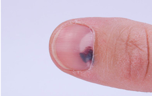 肝脏|肝不好的人，早起后会有“4黑、2臭”，养肝功，多做3事