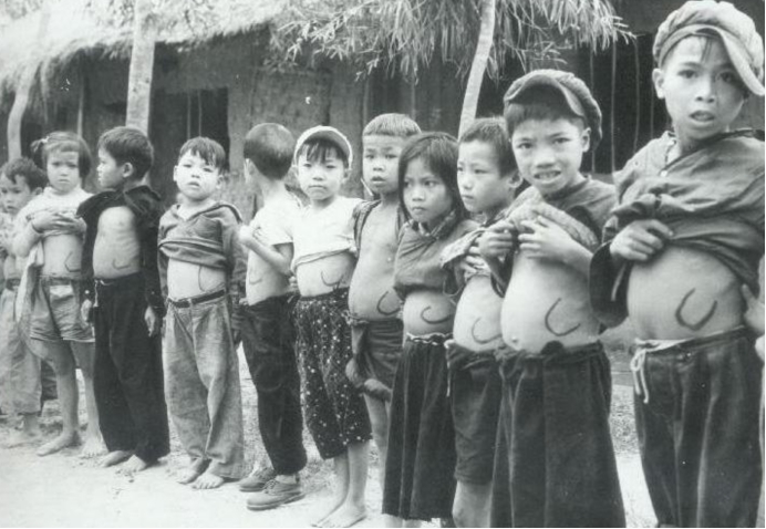 疟原虫 祸害人类200万年的传染病，每年上百万人死亡，曾多次改写人类历史