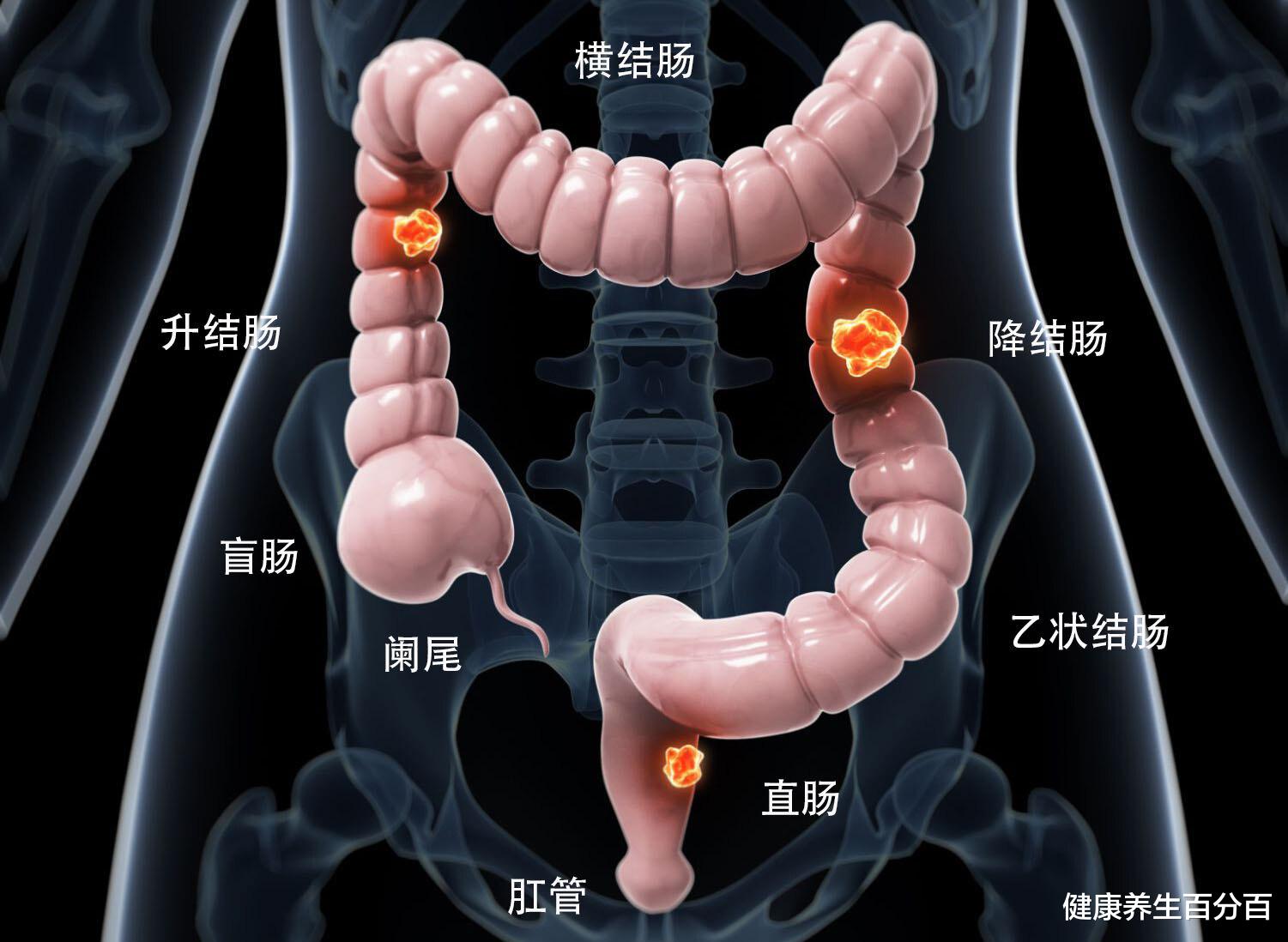 健康养生百分百 右下腹痛没有缓解是阑尾炎吗？阑尾炎就是盲肠炎吗？医生告诉您