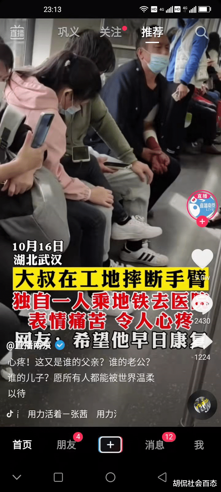 大叔在工地上摔断胳膊,独自忍受剧痛去医院治疗,看哭网友