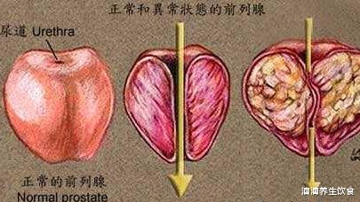 滴滴养生饮食|吃一口等于喝8杯苹果汁，男科医生：超过35岁经常吃，前列腺或更健康