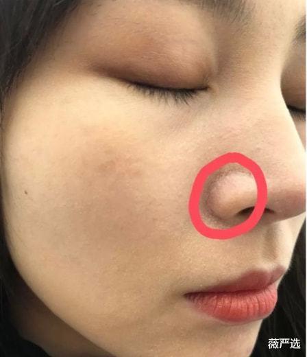 |有种“尴尬”叫女星卡粉，在特写镜头下，妆容浮粉卡粉一言难尽