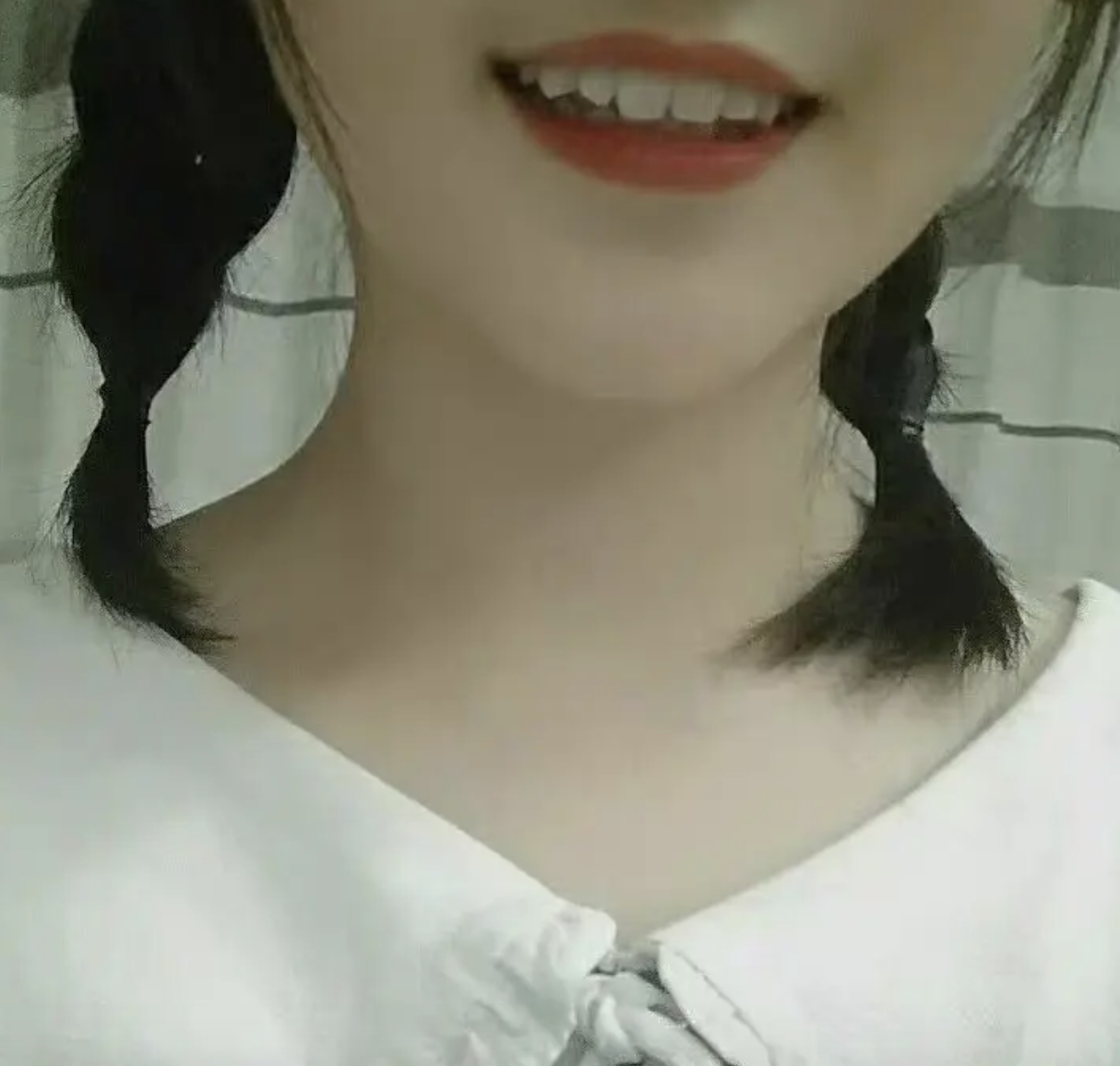 胡萝卜|做全瓷贴面的真实经历分享