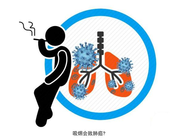 医生胡侃|肺癌找上年轻人！年轻的烟民要注意：4个异常出现，或是肺在报警