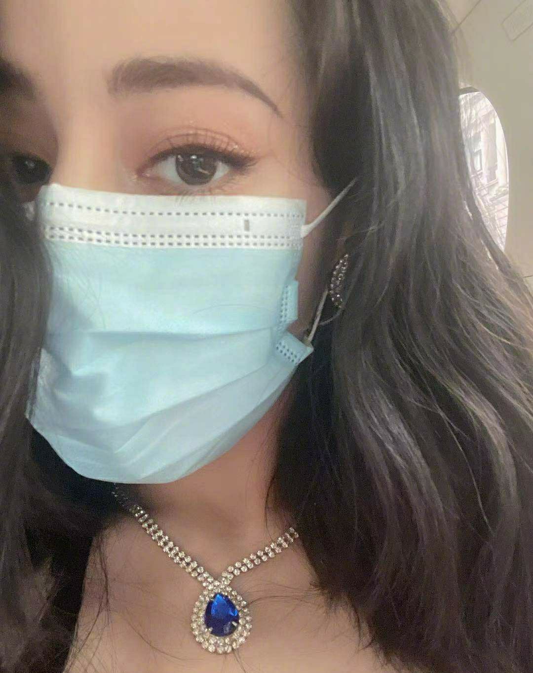 杨紫|迪丽热巴眼睛现麦粒肿，处理方法和赵丽颖如出一辙，效果却不一样