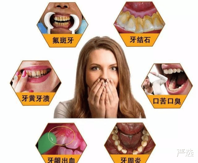牙齿|牙齿又黄又臭的朋友看过来，这个小神器，无需洗牙，都给你搞定！