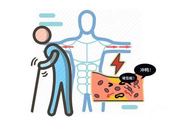 白发|心脑血管医生:2种食物敞开吃,疏通血管,脑梗绕道走