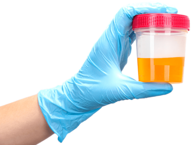 肾病|此类肾病蛋白尿多达数十克，却不易尿毒症！有4点护肾秘诀