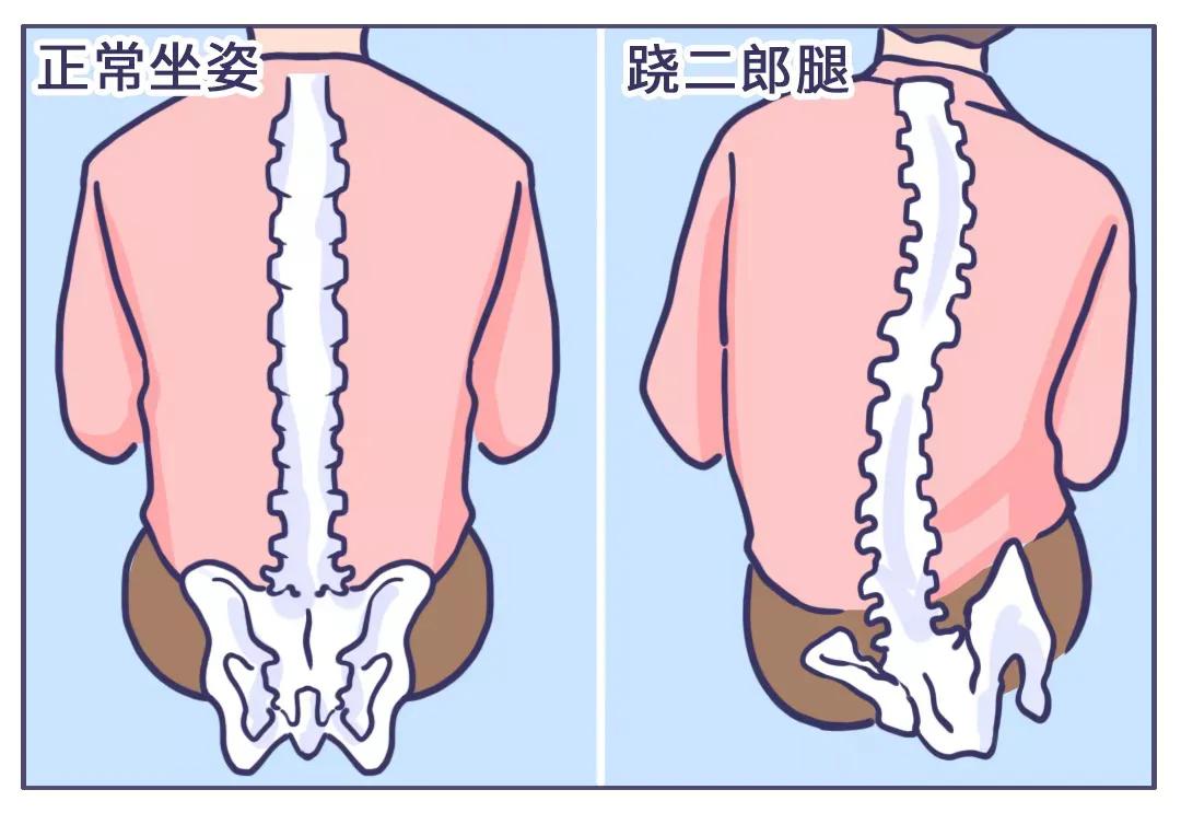 二郎腿|坏习惯在让你变丑你知道吗？