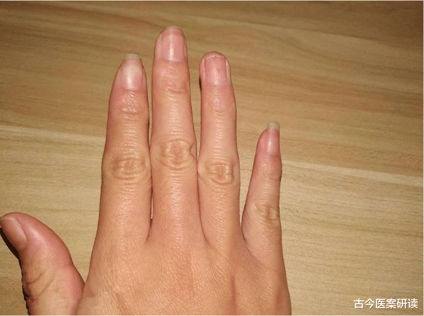 骨质疏松|37岁单身妈妈失眠频繁，查出肝癌，主任：身体早有提示，却不在意