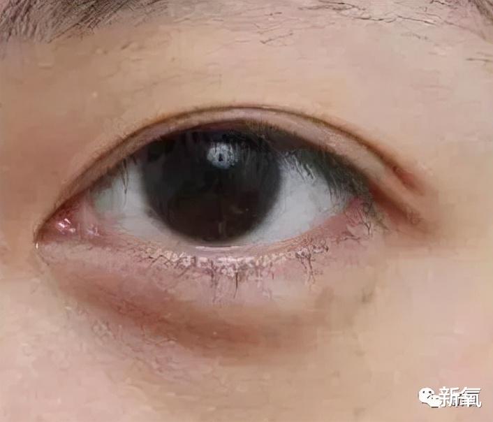 胶原蛋白 看了印度选美冠军的素颜，我裂开了…