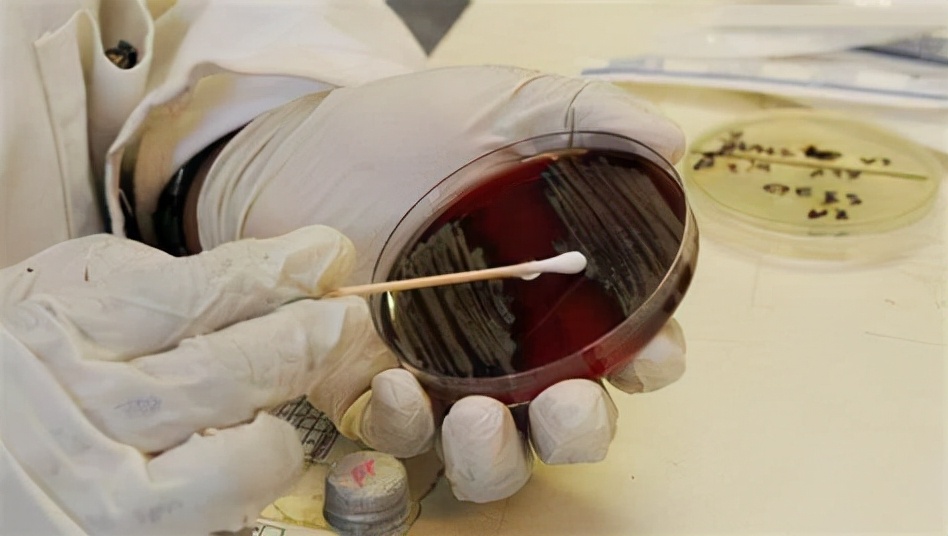 胆固醇|节约不好吗?医生提醒:贪小便宜吃大亏,小心4种“省”出来的癌