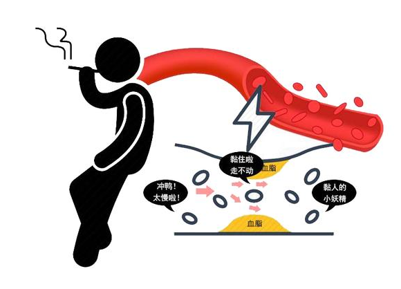 重金属|中风“祸根”公布，并非吸烟，3个原因不及时避开，脑血管迟早崩