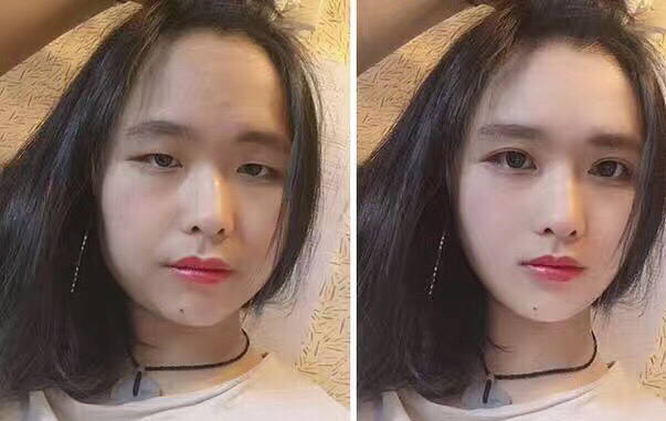 吴奇隆|抖音之夜女星高清镜头，麒麟臂粉刺藏不住，普通人不需有颜值焦虑