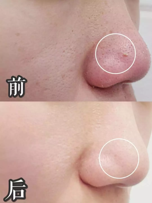 包文婧|包文婧抠的太接地气，大方分享的3款护肤好物，便宜好用