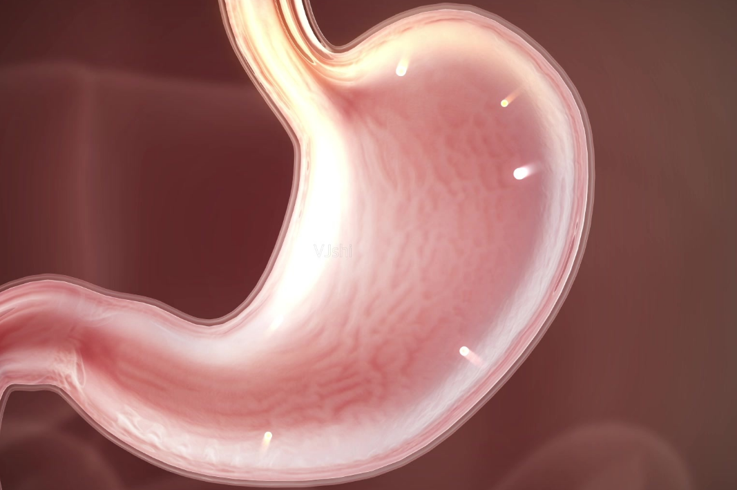 胃溃疡|转告家人:胃就怕缺碱,常吃“4种高碱食物”,胃溃疡或不攻自破