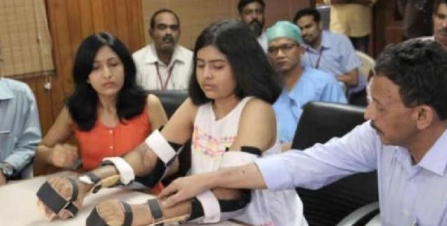 印度女孩因車禍失去雙臂，移植黑人手臂，2年後全身皮膚開始變黑-圖7