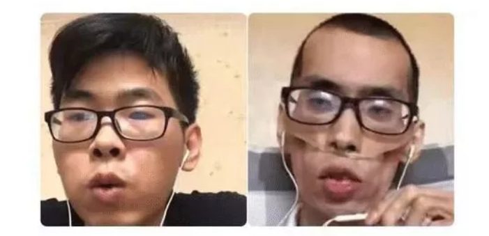 亚西亚健康网|抗癌博主阿健已去世，直肠癌的这些致病因素早了解