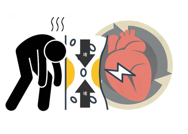 健康周谈|得了冠心病的人若想长寿，这些“雷区”一定不能踩，否则易猝死！