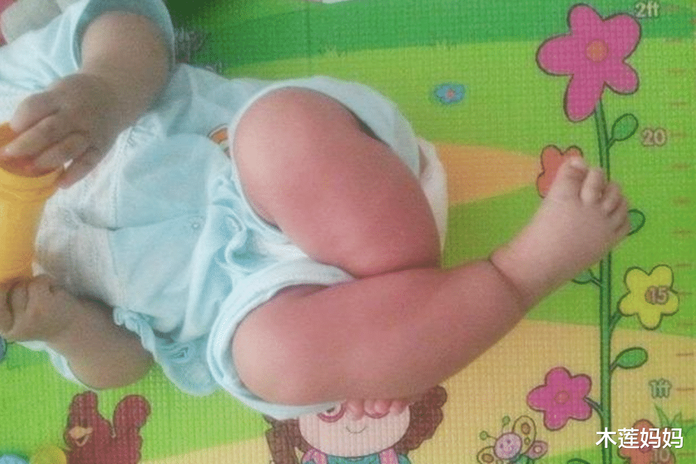 木莲妈妈|孩子频繁夹腿，小心“夹腿综合征”?，正确引导比打骂有用得多