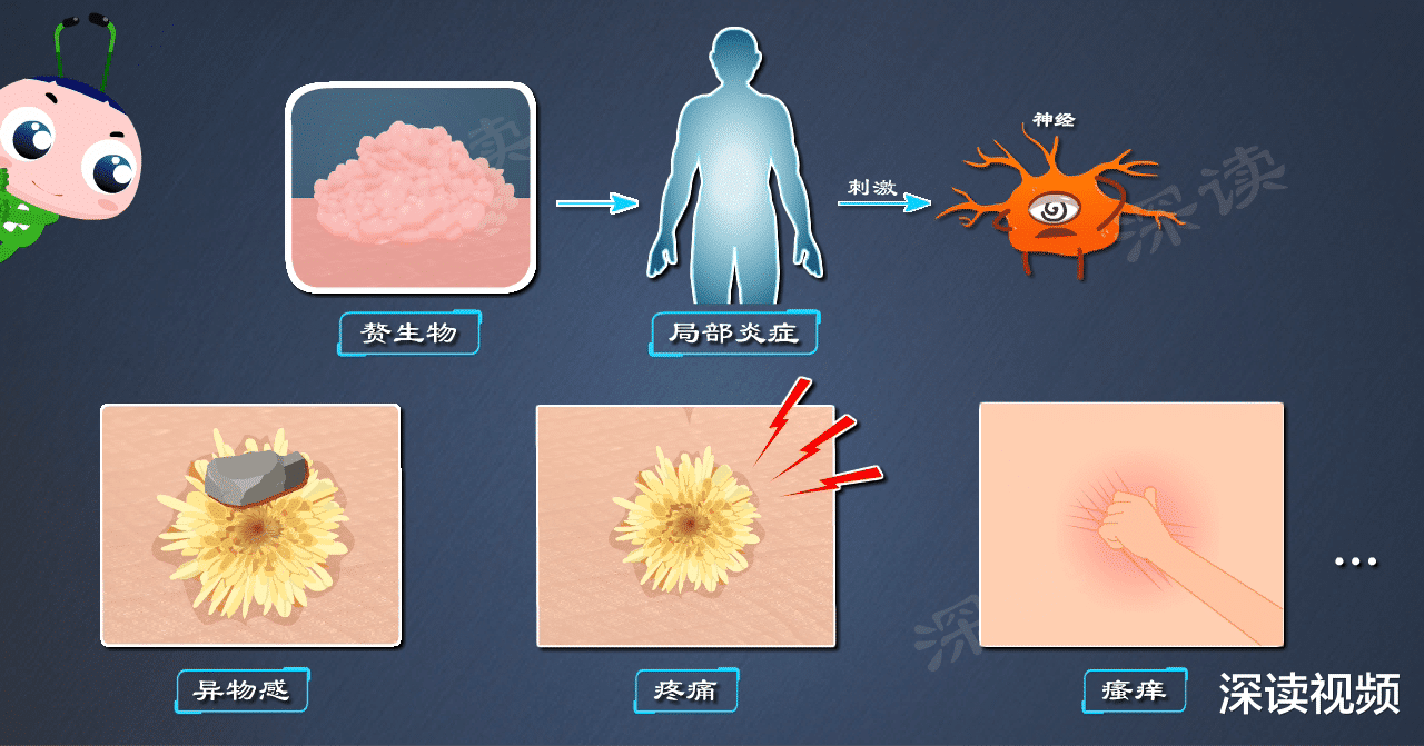 深读视频 明明没出轨，为啥染上尖锐湿疣？还有哪些你不知道的事会招惹HPV？