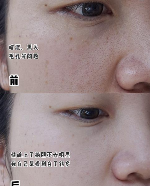 好物官|妻子为讨丈夫欢心带妆睡觉,6年后“烂脸”遭嫌弃,丈夫:离婚吧