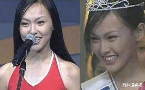 唐嫣|有种“整容”叫明星整牙，胡歌还是胡歌，唐嫣却像变了个模样