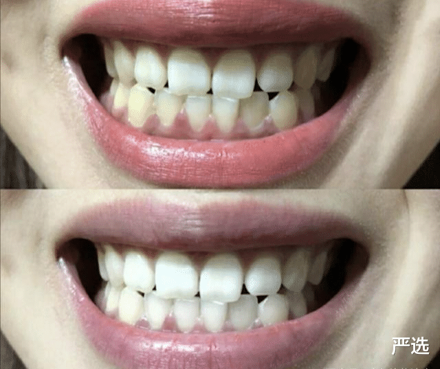 严选|李佳琦力荐的“美白牙膏”火了，网友：我用1年了，黄牙变白