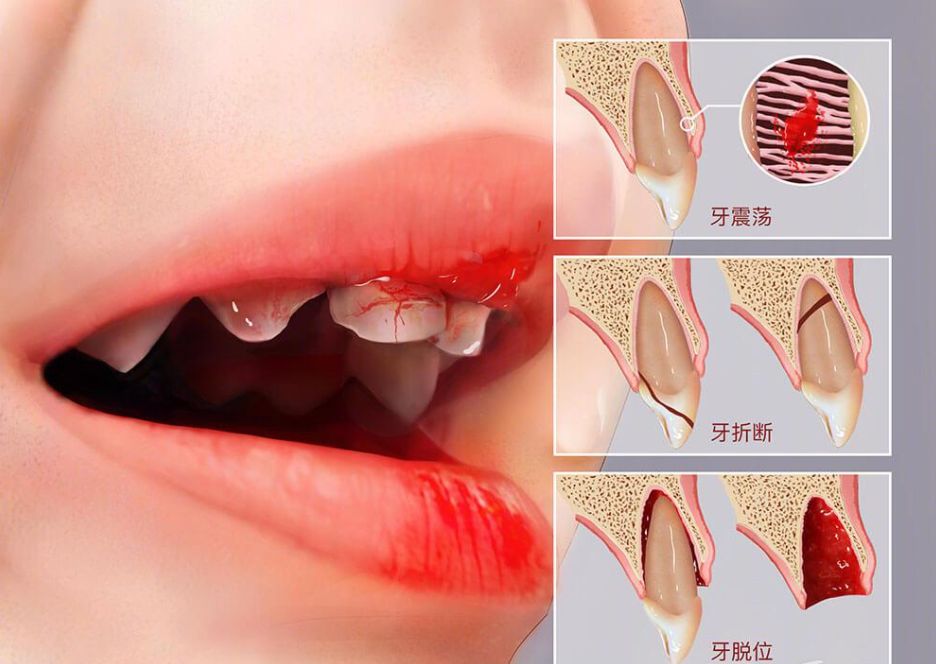 急诊室老苗|为啥拔牙必须上午去?医生的讲究不是没道理,保护孩子牙齿很重要