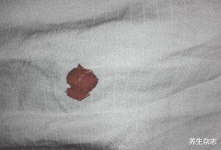 |女教师感染HPV，医生提醒：若感染HPV，身上会有3种迹象