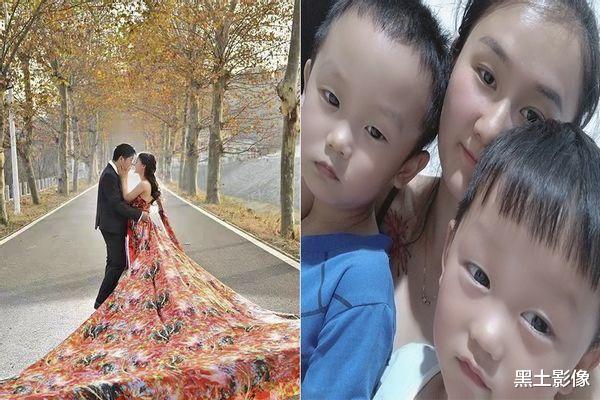 黑土影像 安徽一2岁男童眼睛突然发光疑似猫眼,医生看了后说眼球保不住了