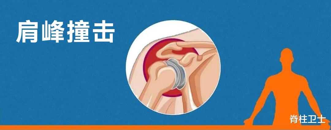 高血脂|这几个常见的肩痛原因你了解吗？什么时候要康复？