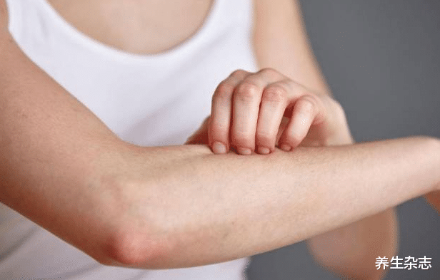 肝脏|体内有癌，皮肤先知！专家：皮肤若有3种异常，八成是肝癌上门，早查肝CT