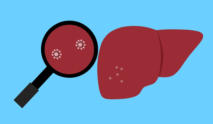 枸杞|养肝食物前三名被公示,枸杞仅居第二,肝不好的人可多吃!