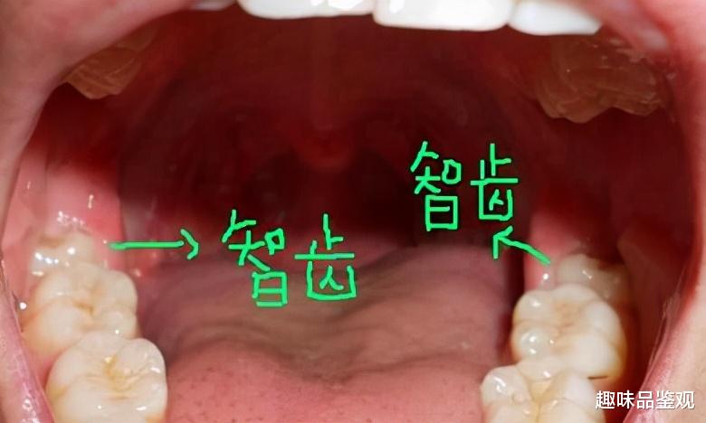 科学家 科学家发现人类正在加速进化，这意味着什么？一些特征已出现