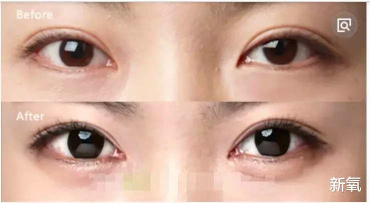 翁帆|等一下！周冬雨被张艺谋选中之前眼睛这么大的吗？