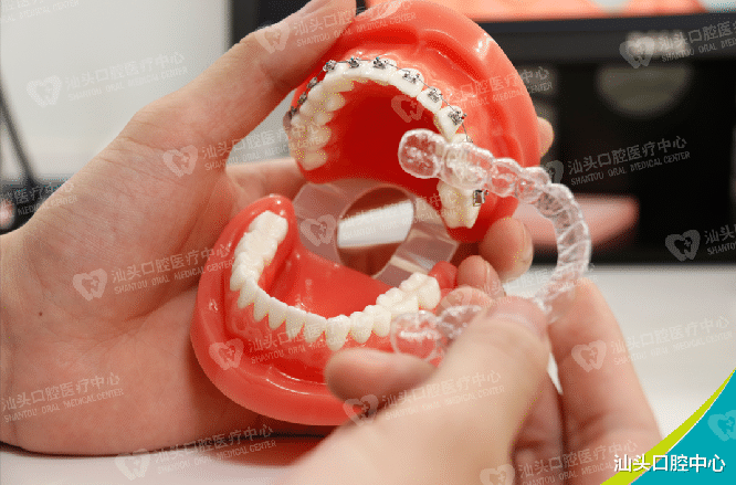 汕头口腔中心|如何挑选靠谱的正畸医生？拿来吧你！