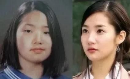 整容|整容天花板？压倒性的美貌和精湛的演技让她成为收视保障