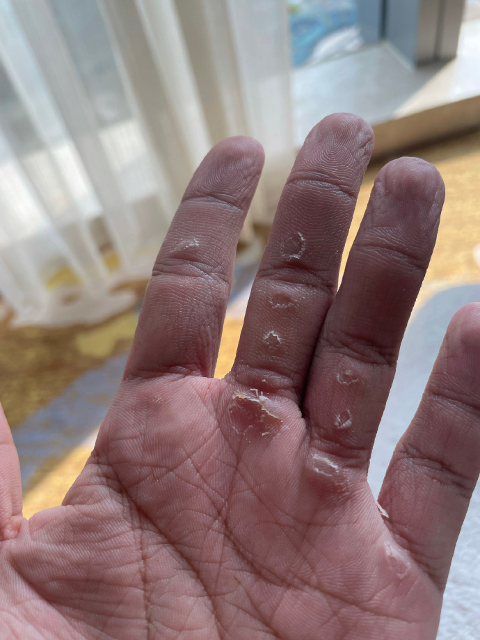 健身圈一哥 22岁肌肉大男孩,撸铁的双手长满了茧,塑造出令人羡慕的腱子肉!