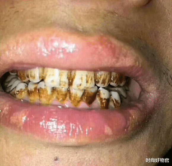 时尚好物官|景甜无意中晒出自己用的牙膏，竟因太便宜被看不起，网友：用了半管黄渍就没了