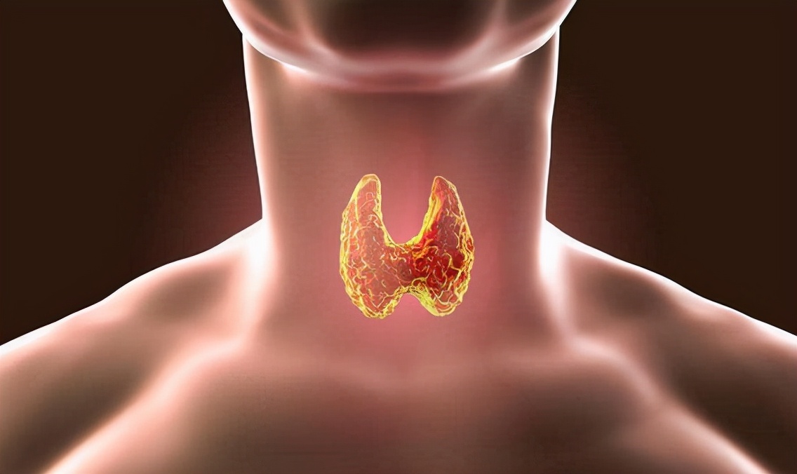 痛风|散结“冠军”被扒出，不是猕猴桃，医生：早晚各一次，养出婴儿甲状腺