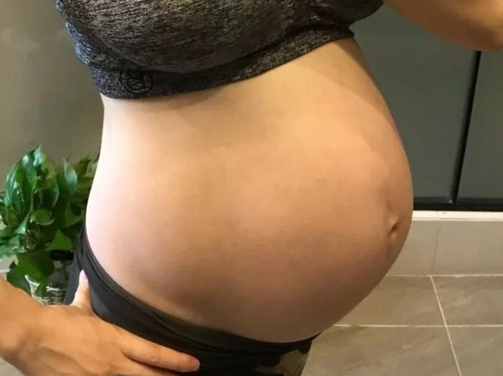 夏小可育儿|不想让妊娠纹毁了肚子？产前产后预防4步曲，宝妈一步都不能落！