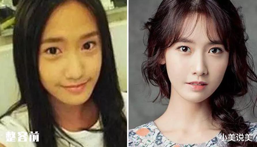 小美说美 究竟怎样才能整出自然、精致的鼻子呢?