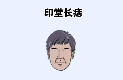 中国易经风水 身体4颗“穷”痣，命里无财，吃不起饭，穿不起衣，在外难抬头！