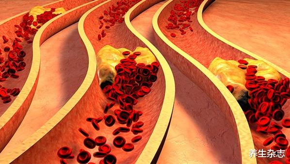 饮食|早上是降脂“黄金期”，坚持吃这4种早餐，血脂或会“乖乖服帖”