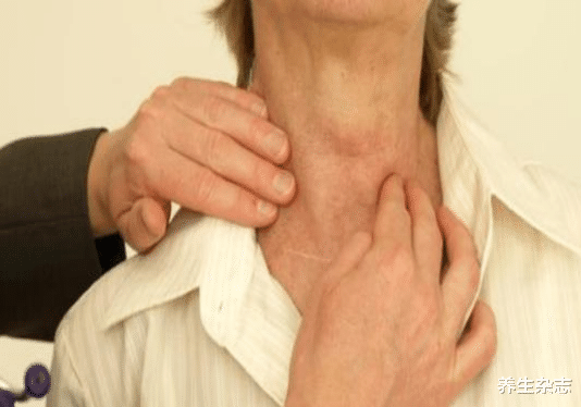 芋头|天然的“散结王”已找到，蒲公英、芋头往后靠，榜首很多人在吃