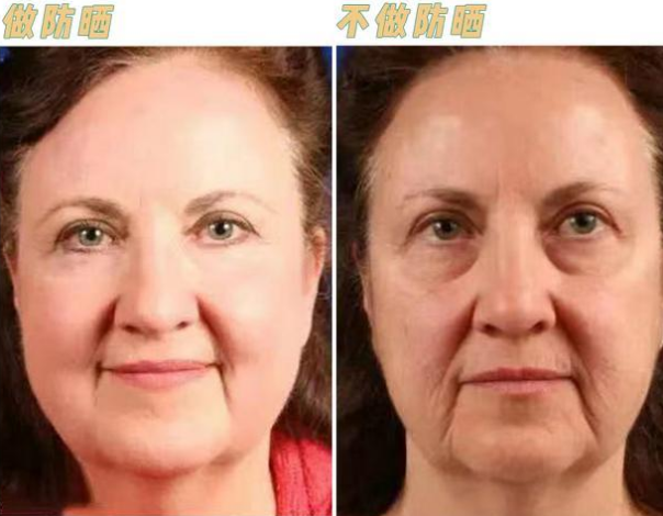 fashion美尚|皮肤科主任:这4个夏季护肤误区,好多人都做错了,你踩雷了吗?