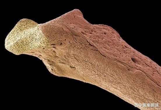 医生|吃一口等于8斤紫菜,骨科医生:常吃可使骨头硬如混凝土